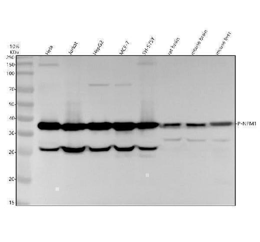 Anti-Phospho-Nucleophosmin (S125) Rabbit Monoclonal Antibody Boster Bio