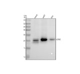 Anti-Lipocalin-2 LCN2 Rabbit Monoclonal Antibody Boster Bio