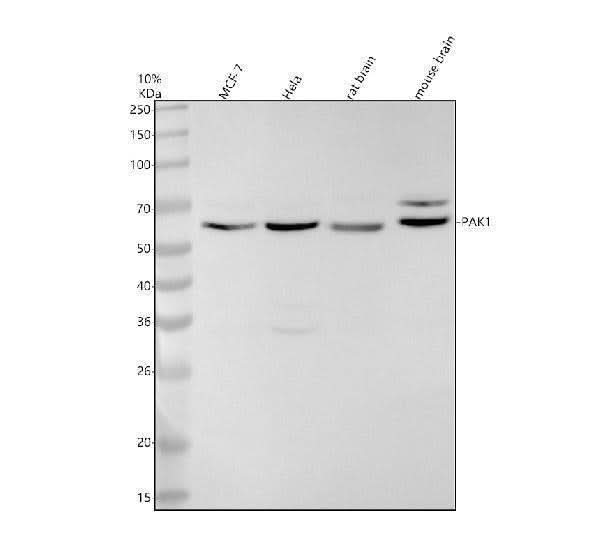 Anti-PAK1 Monoclonal Antibody Boster Bio