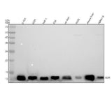Anti-beta 2 Microglobulin B2M Rabbit Monoclonal Antibody Boster Bio