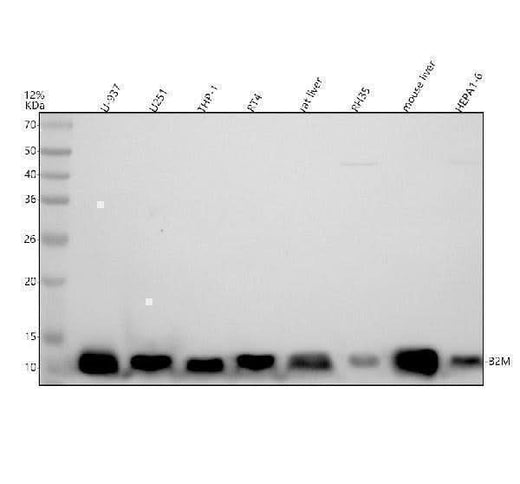 Anti-beta 2 Microglobulin B2M Rabbit Monoclonal Antibody Boster Bio