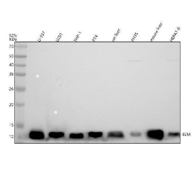 Anti-beta 2 Microglobulin B2M Rabbit Monoclonal Antibody Boster Bio