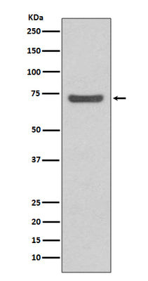 Anti-ABCG2/Bcrp Rabbit Monoclonal Antibody Boster Bio
