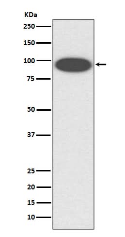 Anti-CD18 ITGB2 Rabbit Monoclonal Antibody Boster Bio