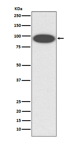 Anti-CD18 ITGB2 Rabbit Monoclonal Antibody Boster Bio
