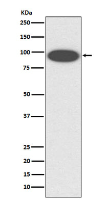 Anti-CD18 ITGB2 Rabbit Monoclonal Antibody Boster Bio