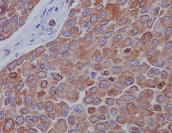 Anti-Mitofusin 2 MFN2 Rabbit Monoclonal Antibody Boster Bio