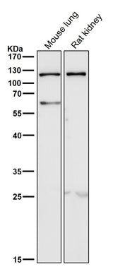 Anti-TLR5 Rabbit Monoclonal Antibody Boster Bio