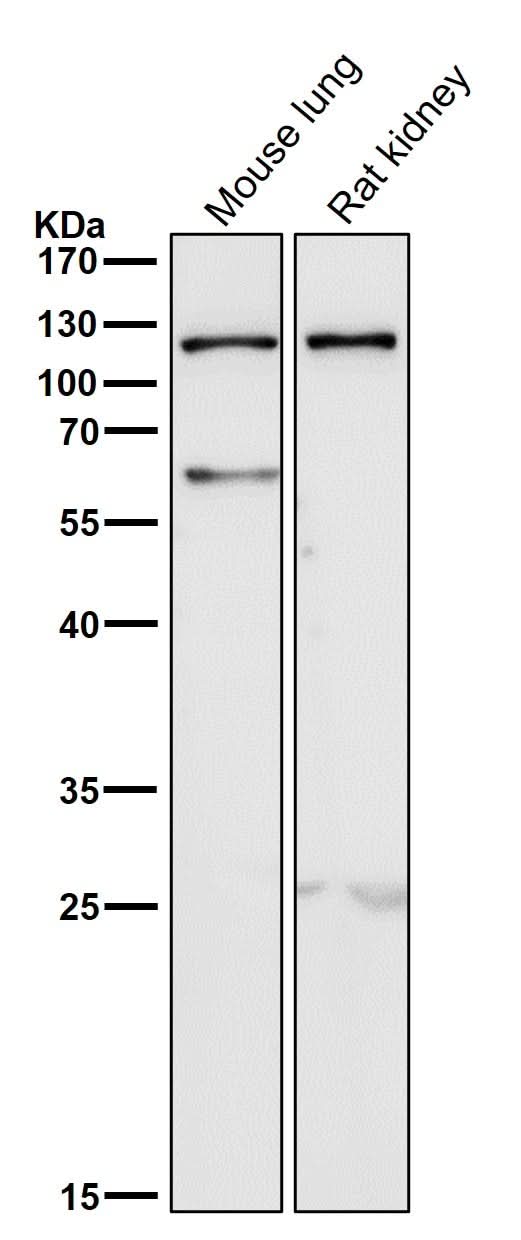 Anti-TLR5 Rabbit Monoclonal Antibody Boster Bio
