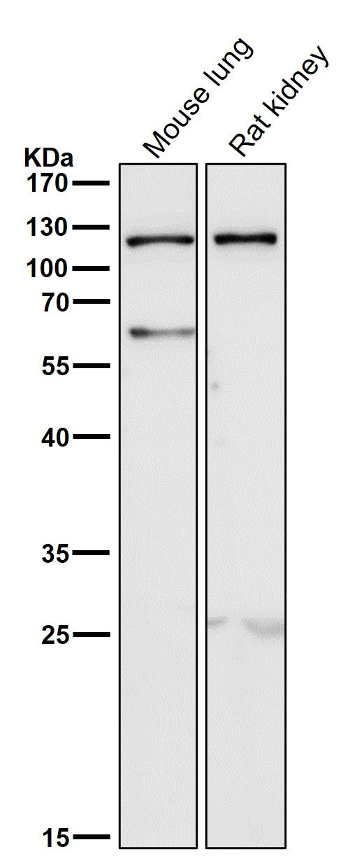 Anti-TLR5 Rabbit Monoclonal Antibody Boster Bio