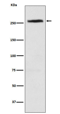 Anti-CAD Rabbit Monoclonal Antibody Boster Bio