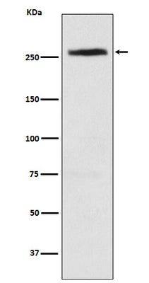 Anti-CAD Rabbit Monoclonal Antibody Boster Bio