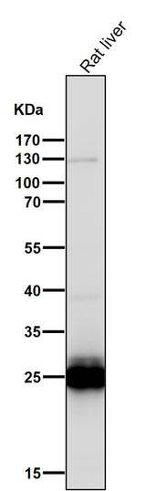 Anti-COMT Rabbit Monoclonal Antibody Boster Bio