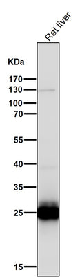 Anti-COMT Rabbit Monoclonal Antibody Boster Bio