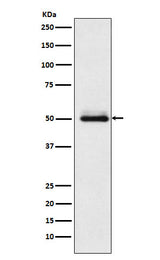 Anti-Cytochrome P450 2C9 Rabbit Monoclonal Antibody Boster Bio