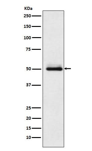 Anti-Cytochrome P450 2C9 Rabbit Monoclonal Antibody Boster Bio