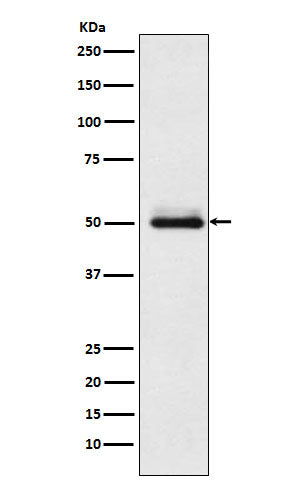 Anti-Cytochrome P450 2C9 Rabbit Monoclonal Antibody Boster Bio