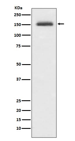 Anti-Integrin alpha 4 ITGA4 Rabbit Monoclonal Antibody Boster Bio