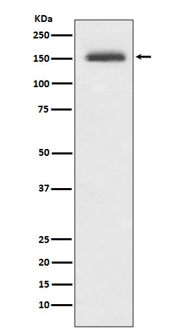 Anti-Integrin alpha 4 ITGA4 Rabbit Monoclonal Antibody Boster Bio