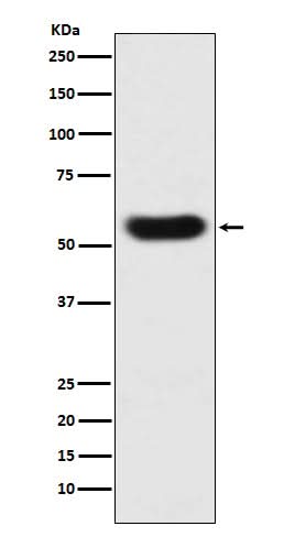 Anti-SERPINC1 Monoclonal Antibody Boster Bio