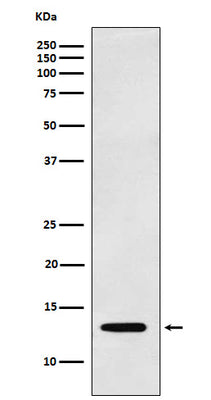 Anti-Galectin 1 LGALS1 Monoclonal Antibody Boster Bio