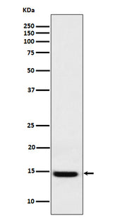Anti-Galectin 1 Rabbit Monoclonal Antibody Boster Bio