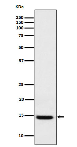 Anti-Galectin 1 Rabbit Monoclonal Antibody Boster Bio