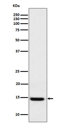 Anti-Galectin 1 Rabbit Monoclonal Antibody Boster Bio