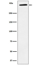 Anti-ApoA Rabbit Monoclonal Antibody Boster Bio
