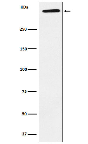 Anti-ApoA Rabbit Monoclonal Antibody Boster Bio