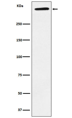 Anti-ApoA Rabbit Monoclonal Antibody Boster Bio