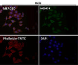 Anti-OGT Monoclonal Antibody Boster Bio