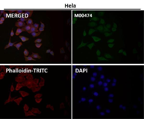 Anti-OGT Monoclonal Antibody Boster Bio