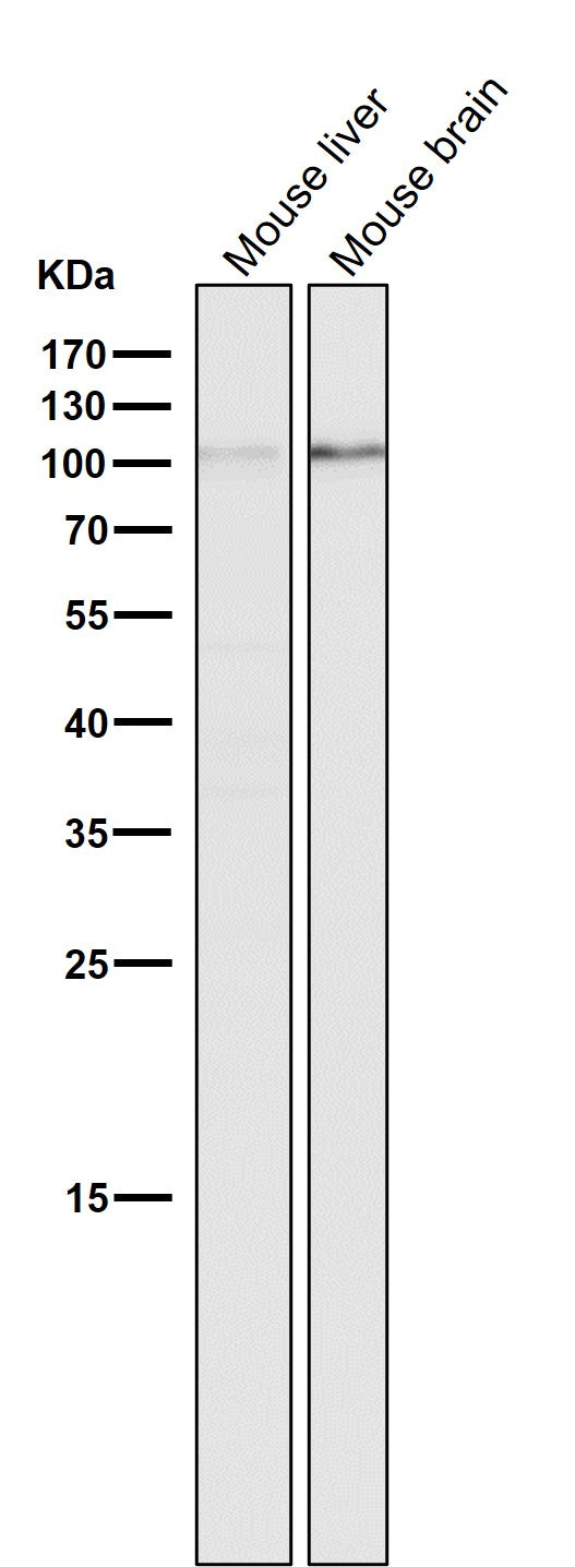 Anti-DGCR8 Rabbit Monoclonal Antibody Boster Bio