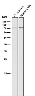 Anti-DGCR8 Rabbit Monoclonal Antibody Boster Bio