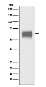 Anti-CD5 Monoclonal Antibody Boster Bio