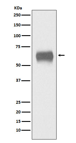 Anti-CD5 Monoclonal Antibody Boster Bio