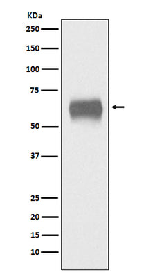 Anti-CD5 Monoclonal Antibody Boster Bio