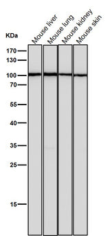 Anti-TPOR Rabbit Monoclonal Antibody Boster Bio