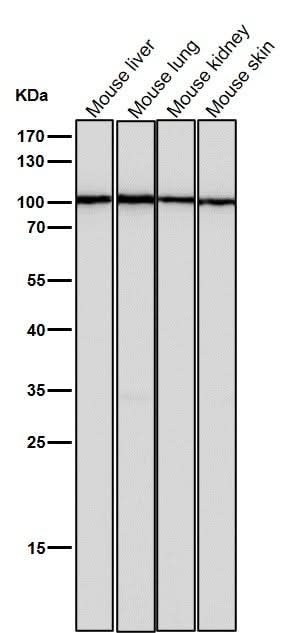 Anti-TPOR Rabbit Monoclonal Antibody Boster Bio