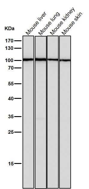 Anti-TPOR Rabbit Monoclonal Antibody Boster Bio