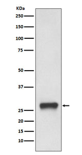 Anti-MHC Class II HLA-DPB1 Rabbit Monoclonal Antibody Boster Bio