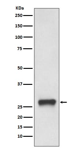 Anti-MHC Class II HLA-DPB1 Rabbit Monoclonal Antibody Boster Bio