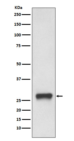 Anti-MHC Class II HLA-DPB1 Rabbit Monoclonal Antibody Boster Bio
