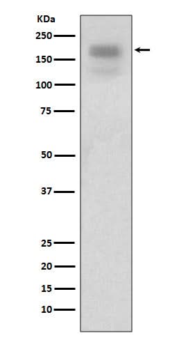 Anti-MERTK/Mer Rabbit Monoclonal Antibody Boster Bio