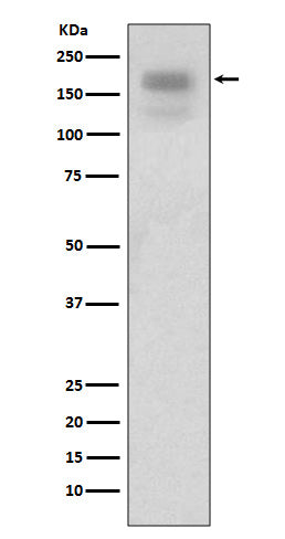 Anti-MERTK/Mer Rabbit Monoclonal Antibody Boster Bio