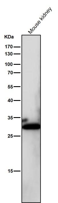 Anti-NQO1/Dt Diaphorase Rabbit Monoclonal Antibody Boster Bio