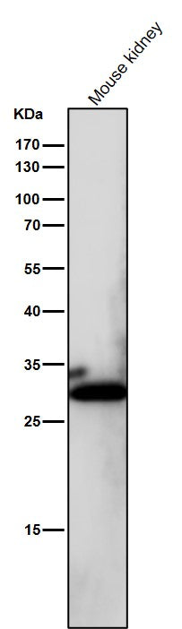 Anti-NQO1/Dt Diaphorase Rabbit Monoclonal Antibody Boster Bio