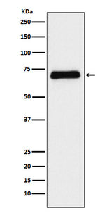 Anti-Serotonin transporter Rabbit Monoclonal Antibody Boster Bio