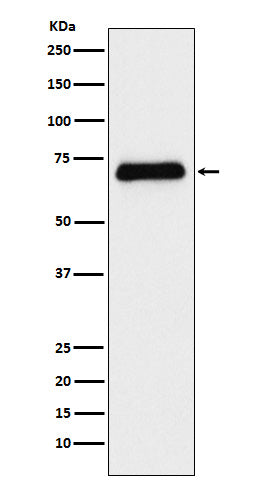 Anti-Serotonin transporter Rabbit Monoclonal Antibody Boster Bio